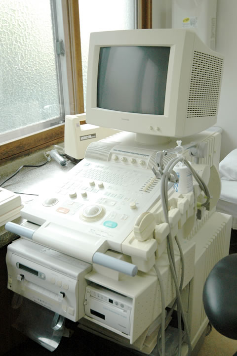 超音波診断装置